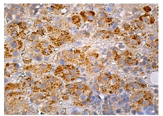 Galanin (H-11): sc-166431. Immunoperoxidase staining of formalin fixed, paraffin-embedded human adrenal gland tissue showing cytoplasmic staining of glandular cells.