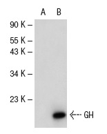 GH (T-20): sc-10365. Western blot analysis of GH expression in non-transfected: sc-117752 (A) and human GH transfected: sc-111489 (B) 293T whole cell lysates.