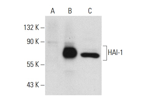 HAI-1 (H-180): sc-30205. Western blot analysis of HAI-1 expression in non-transfected: sc-117752 (A) and human HAI-1 transfected: sc-159178 (B) 293T whole cell lysates and human platelet extract (C).