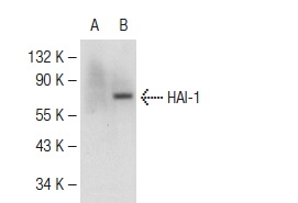HAI-1 (H-180): sc-30205. Western blot analysis of HAI-1 expression in non-transfected: sc-117752 (A) and mouse HAI-1 transfected: sc-110417 (B) 293T whole cell lysates.