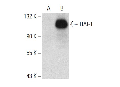 HAI-1 (T-20): sc-23602. Western blot analysis of HAI-1 expression in non-transfected: sc-117752 (A) and human HAI-1 transfected: sc-159178 (B) 293T whole cell lysates.