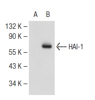 HAI-1 (T-20): sc-23602. Western blot analysis of HAI-1 expression in non-transfected: sc-117752 (A) and mouse HAI-1 transfected: sc-110417 (B) 293T whole cell lysates.