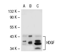 HDGF (C-14): sc-28064. Western blot analysis of HDGF expression in non-transfected 293T: sc-117752 (A), mouse HDGF transfected 293T: sc-120730 (B) and ECV304 (C) whole cell lysates.