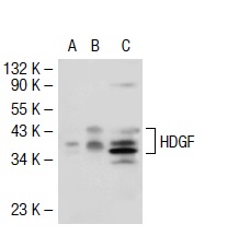 HDGF (C-14): sc-28064. Western blot analysis of HDGF expression in non-transfected 293T: sc-117752 (A), mouse HDGF transfected 293T: sc-120729 (B) and ECV304 (C) whole cell lysates.