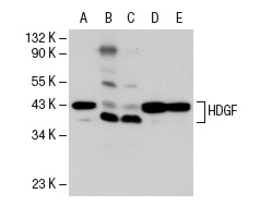 HDGF (C-14)-R: sc-28064-R. Western blot analysis of HDGF expression in HEK293 (A), HeLa (B), ECV304 (C), KNRK (D) and EOC 20 (E) whole cell lysates.
