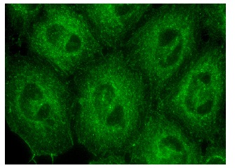 HDGF (C-14)-R: sc-28064-R. Immunofluorescence staining of methanol-fixed HeLa cells showing cytoplasmic and membrane localization.