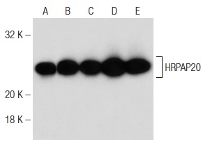 HRPAP20 (H-9): sc-166929. Western blot analysis of HRPAP20 expression in T-47D (A), Ramos (B), MDA-MB-231 (C), K-562 (D) and Raji (E) whole cell lysates.