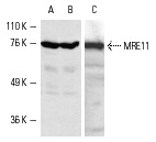 MRE11 (C-16): sc-5859. Western blot analysis of MRE11 expression in K-562 (A), HeLa (B) and Jurkat (C) whole cell lysates.