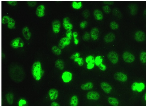 MRE11 (C-16): sc-5859. Immunofluorescence staining of formalin-fixed HeLa cells showing nuclear localization. Kindly provided by Yang Xiang, Ph.D., Division of Newborn Medicine, Boston Childrens Hospital, Cell Biology Department, Harvard Medical School.