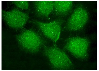 MRE11 (C-16): sc-5859. Immunofluorescence staining of methanol-fixed HeLa cells showing nuclear and cytoplasmic localization.