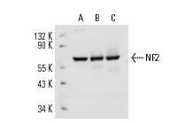 NF2 (B-12): sc-55575. Western blot analysis of NF2 expression in MCF7 (A), CSMLO (B) and KNRK (C) whole cell lysates.