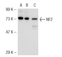 NF2 (B-12): sc-55575. Western blot analysis of NF2 expression in non-transfected 293T: sc-117752 (A), mouse NF2 transfected 293T: sc-125701 (B) and HeLa (C) whole cell lysates.