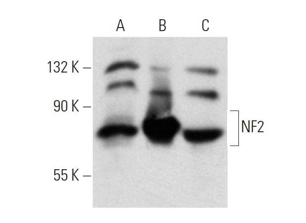 NF2 (B-12): sc-55575. Western blot analysis of NF2 expression in non-transfected 293T: sc-117752 (A), human NF2 transfected 293T: sc-172383 (B) and Jurkat (C) whole cell lysates.