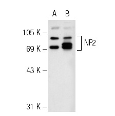 NF2 (B-12): sc-55575. Western blot analysis of NF2 expression in non-transfected: sc-117752 (A) and human NF2 transfected: sc-172636 (B) 293T whole cell lysates.