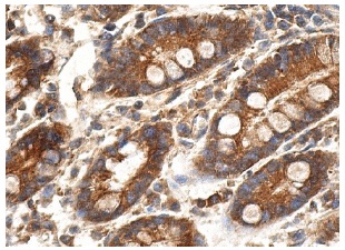 NF2 (B-12): sc-55575. Immunoperoxidase staining of formalin fixed, paraffin-embedded human duodenum tissue showing cytoplasmic staining of glandular cells.