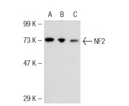 NF2 (E-2): sc-55574. Western blot analysis of NF2 expression in non-transfected 293T: sc-117752 (A), mouse NF2 transfected 293T: sc-125701 (B) and HeLa (C) whole cell lysates.