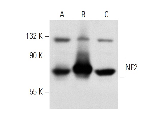 NF2 (E-2): sc-55574. Western blot analysis of NF2 expression in non-transfected 293T: sc-117752 (A), human NF2 transfected 293T: sc-172383 (B) and Jurkat (C) whole cell lysates.