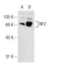 NF2 (E-2): sc-55574. Western blot analysis of NF2 expression in non-transfected: sc-117752 (A) and human NF2 transfected: sc-172636 (B) 293T whole cell lysates.
