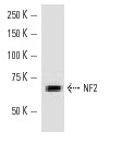 NF2 (H-260): sc-28247. Western blot analysis of NF2 expression in MCF7 whole cell lysate.