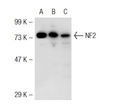 NF2 (H-260): sc-28247. Western blot analysis of NF2 expression in non-transfected 293T: sc-117752 (A), mouse NF2 transfected 293T: sc-125701 (B) and HeLa (C) whole cell lysates.
