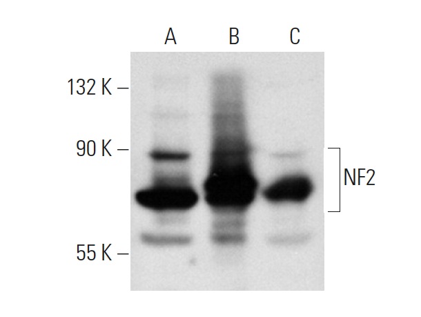 NF2 (H-260): sc-28247. Western blot analysis of NF2 expression in non-transfected 293T: sc-117752 (A), human NF2 transfected 293T: sc-172383 (B) and Jurkat (C) whole cell lysates.