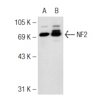 NF2 (H-260): sc-28247. Western blot analysis of NF2 expression in non-transfected: sc-117752 (A) and human NF2 transfected: sc-172636 (B) 293T whole cell lysates.