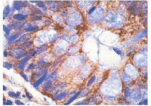 NF2 (A-19): sc-331. Immunoperoxidase staining of formalin-fixed, paraffin-embedded normal human colon showing localized staining within the cytoplasm.
