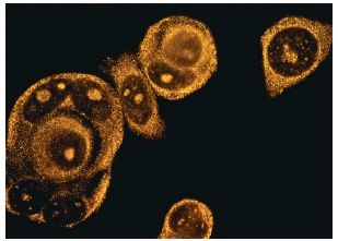 NF2 (A-19): sc-331. Rhodamine immunofluorescence staining of methanol-fixed MCF7 cells showing diffuse as well as localized cytoplasmic staining.