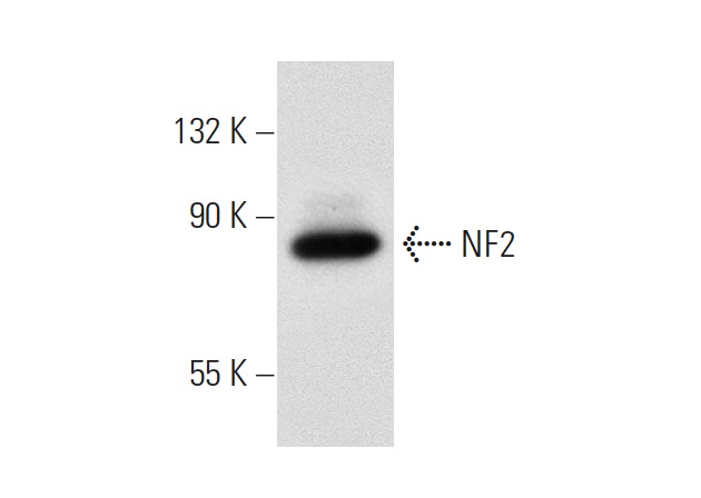 NF2 (A-19): sc-331. Western blot analysis of NF2 expression in Jurkat whole cell lysate.