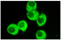 NF2 (C-18): sc-332. Immunofluorescence staining of methanol-fixed KNRK cells showing cytoplasmic staining.