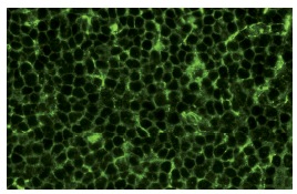 NF2 (C-18): sc-332. Immunofluorescence staining of normal mouse lymph node frozen section showing cytoplasmic staining.