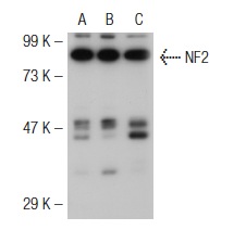 NF2 (C-18): sc-332. Western blot analysis of NF2 expression in non-transfected 293T: sc-117752 (A), mouse NF2 transfected 293T: sc-125701 (B) and HeLa (C) whole cell lysates.