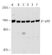 p107 (C-18): sc-318. Western blot analysis of p107 expression in SK-BR-3 (A), C32 (B), NIH/3T3 (C), MM-142 (D), KNRK (E) and 3611-RF (F) whole cell lysates.