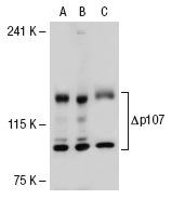 p107 (C-18): sc-318. Western blot analysis of p107 expression in non-transfected 293T: sc-117752 (A), truncated human p107 transfected 293T: sc-114727 (B) and SK-BR-3 (C) whole cell lysates.