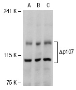 p107 (C-18)-G: sc-318-G. Western blot analysis of p107 expression in non-transfected 293T: sc-117752 (A), truncated human p107 transfected 293T: sc-114727 (B) and SK-BR-3 (C) whole cell lysates.