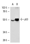 p53 (Pab 240): sc-99. Western blot analysis of p53 expression in A-431 (A) and mouse Lac Z (B) whole cell lysates.