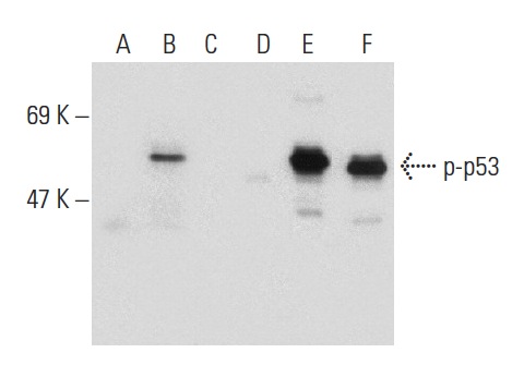 Western blot analysis of p53 phosphorylation in non-transfected: sc-117752 (A,D), untreated human p53 transfected: sc-158802 (B,E) and lambda protein phosphatase (sc-200312A) treated human p53 transfected: sc-158802 (C,F) 293T whole cell lysates. Antibodies tested include p-p53 (Ser 315): sc-101763 (A,B,C) and p53 (Pab 240): sc-99 (D,E,F).