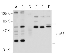Western blot analysis of p53 phosphorylation in untreated (A,D), UV irradiated (B,E) and UV irradiated and lambda protein phosphatase treated (C,F) Cos whole cell lysates. Antibodies tested include p-p53 (hSer 20)-R: sc-18079-R (A,B,C) and p53 (Pab 240): sc-99 (D,E,F).