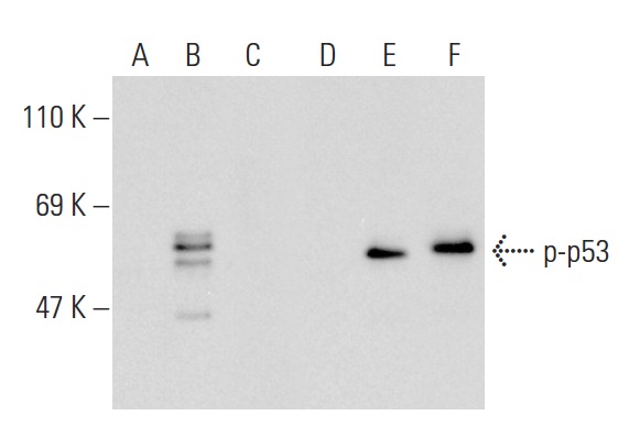 Western blot analysis of p53 phosphorylation in non-transfected: sc-117752 (A,D), untreated human p53 transfected: sc-158802 (B,E) and lambda protein phosphatase treated human p53 transfected: sc-158802 (C,F) 293T whole cell lysates. Antibodies tested include p--p53 (Ser 46): sc-101764 (A,B,C) and p53 (Pab 240): sc-99 (D,E,F).