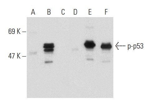 Western blot analysis of p53 phosphorylation in non-transfected: sc-117752 (A,D), untreated human p53 transfected: sc-158802 (B,E) and lambda protein phosphatase (sc-200312A) treated human p53 transfected: sc-158802 (C,F) 293T whole cell lysates. Antibodies tested include p-p53 (Ser 46): sc-101764 (A,B,C) and p53 (Pab 240): sc-99 (D,E,F).