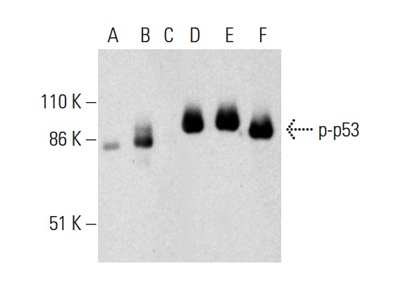 Western blot analysis of p53 phosphorylation in untreated (A,D), ERK2 treated (B,E) and ERK2 and lambda protein phosphatase (sc-200312A) treated (C,F) human recombinant p53. Antibodies tested include p-p53 (Thr 55)-R: sc-12904-R. (A,B,C) and p53 (Pab 240): sc-99 (D,E,F).