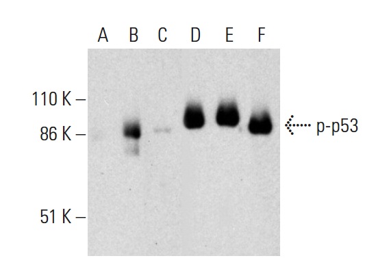 Western blot analysis of p53 phosphorylation in untreated (A,D), ERK2 treated (B,E) and ERK2 and lambda protein phosphatase (sc-200312A) treated (C,F) human recombinant p53. Antibodies tested include p-p53 (B-3): sc-377553. (A,B,C) and p53 (Pab 240): sc-99 (D,E,F).