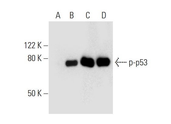 Western blot analysis of p53 phosphorylation in untreated (A,C) and DNA-PK treated (B,D) p53 recombinant proteins. Antibodies tested include p-p53 (Ser 15): sc-101762 (A,B) and p53 (Pab 240): sc-99 (C,D).