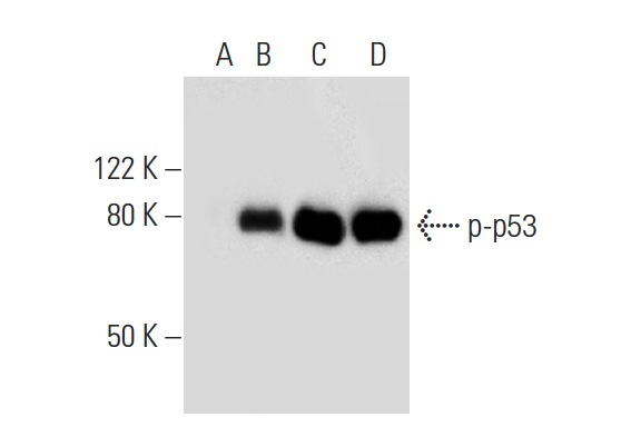 Western blot analysis of p53 phosphorylation in untreated (A,C) and DNA-PK treated (B,D) p53 recombinant proteins. Antibodies tested include p-p53 (Ser 37): sc-135633 (A,B) and p53 (Pab 240): sc-99 (C,D).