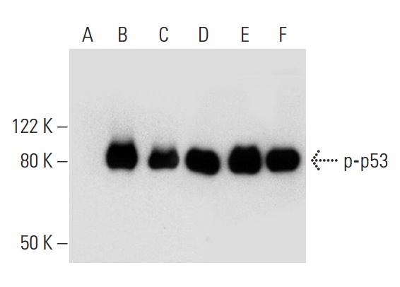 Western blot analysis of p53 phosphorylation in untreated (A,D), CHK 1 treated (B,E) and DNA-PK treated (C,F) p53 recombinant proteins. Antibodies tested include p-p53 (Thr 18)-R: sc-16716-R (A,B,C) and p53 (Pab 240): sc-99 (D,E,F).