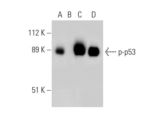 Western blot analysis of p53 phosphorylation in untreated (A,C) and lambda protein phosphatase (sc-200312A) treated (B,D) human recombinant p53. Antibodies tested include p-p53 (Ser 46): sc-101764 (A,B) and p53 (Pab 240): sc-99 (C,D).