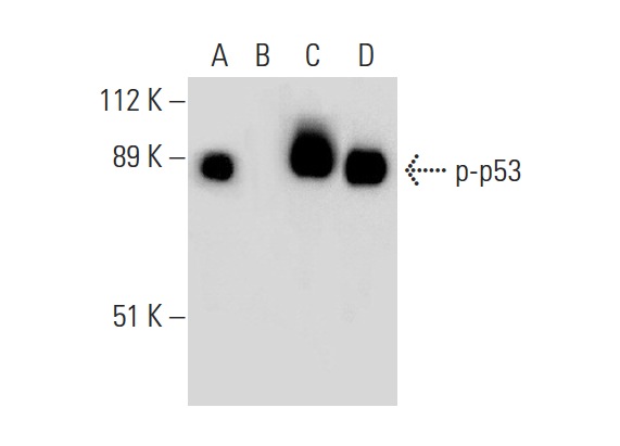 Western blot analysis of p53 phosphorylation in untreated (A,C) and lambda protein phosphatase (sc-200312A) treated (B,D) human recombinant p53. Antibodies tested include p-p53 (F-11): sc-377561 (A,B) and p53 (Pab 240): sc-99 (C,D).