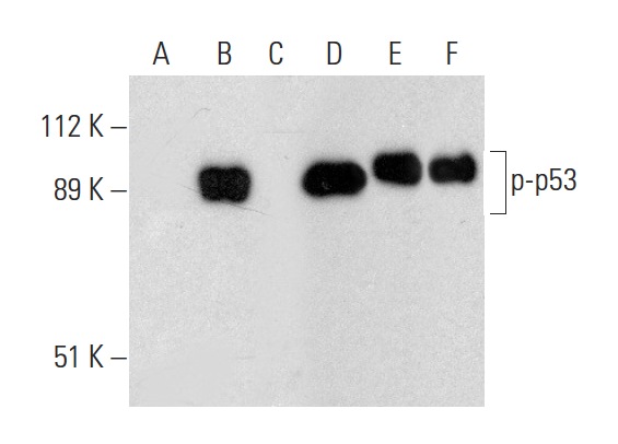 Western blot analysis of p53 phosphorylation in untreated (A,D), CK2a1 treated (B,E) and CK2a1 and lambda protein phosphatase (sc-200312A) treated (C,F) human recombinant p53. Antibodies tested include p-p53 (B-12): sc-377564 (A,B,C) and p53 (Pab 240): sc-99 (D,E,F).