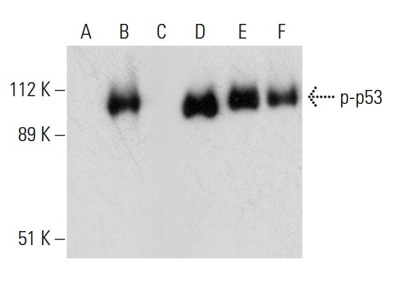 Western blot analysis of p53 phosphorylation in untreated (A,D), CK2a1 treated (B,E) and CK2a1 and lambda protein phosphatase (sc-200312A) treated (C,F) p53 fusion proteins. Antibodies tested include p-p53 (Thr 155): sc-17105 (A,B,C) and p53 (Pab 240): sc-99 (D,E,F).
