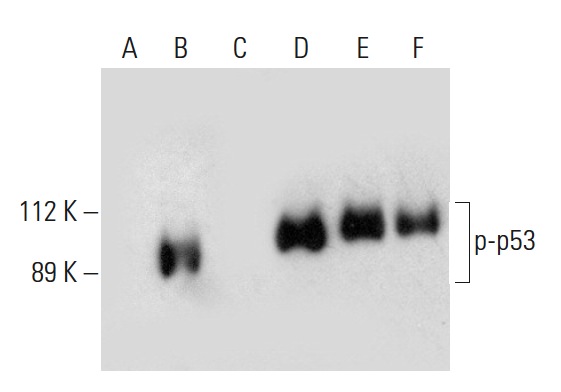 Western blot analysis of p53 phosphorylation in untreated (A,D), CK2a1 treated (B,E) and CK2a1 and lambda protein phosphatase (sc-200312A) treated (C,F) p53 fusion proteins. Antibodies tested include p-p53 (D-9): sc-377567 (A,B,C) and p53 (Pab 240): sc-99 (D,E,F).
